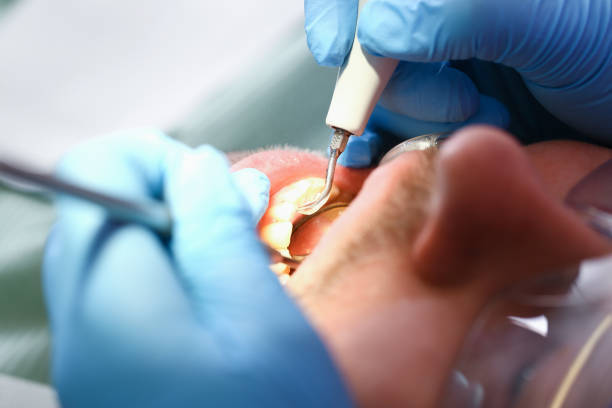 Best Emergency Cosmetic Dentistry in College Station, TX
